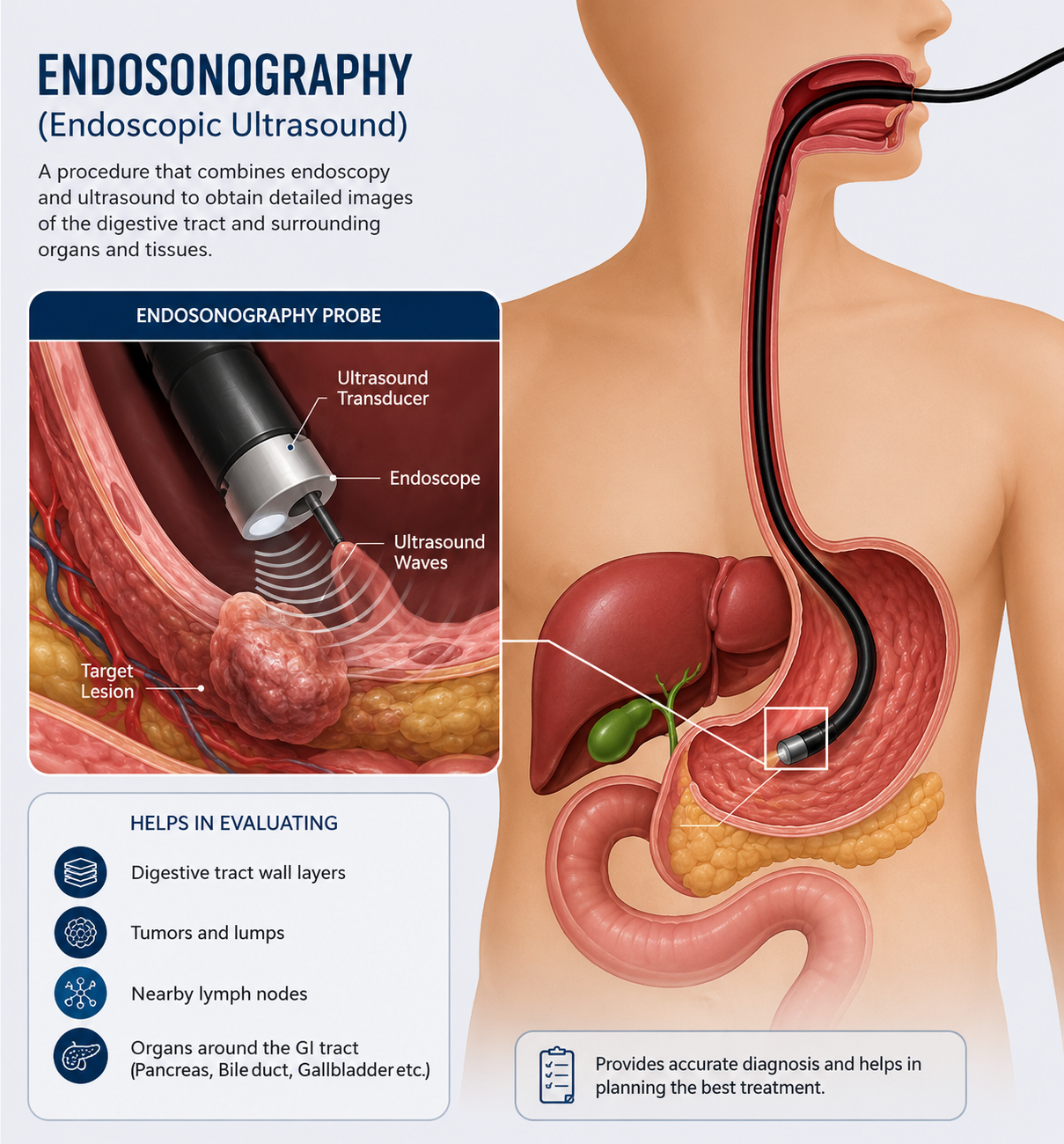 Endosonography / Endoscopic Ultrasound (EUS) procedure